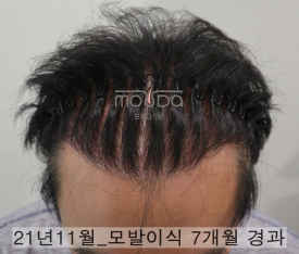 642a10954dffd.png