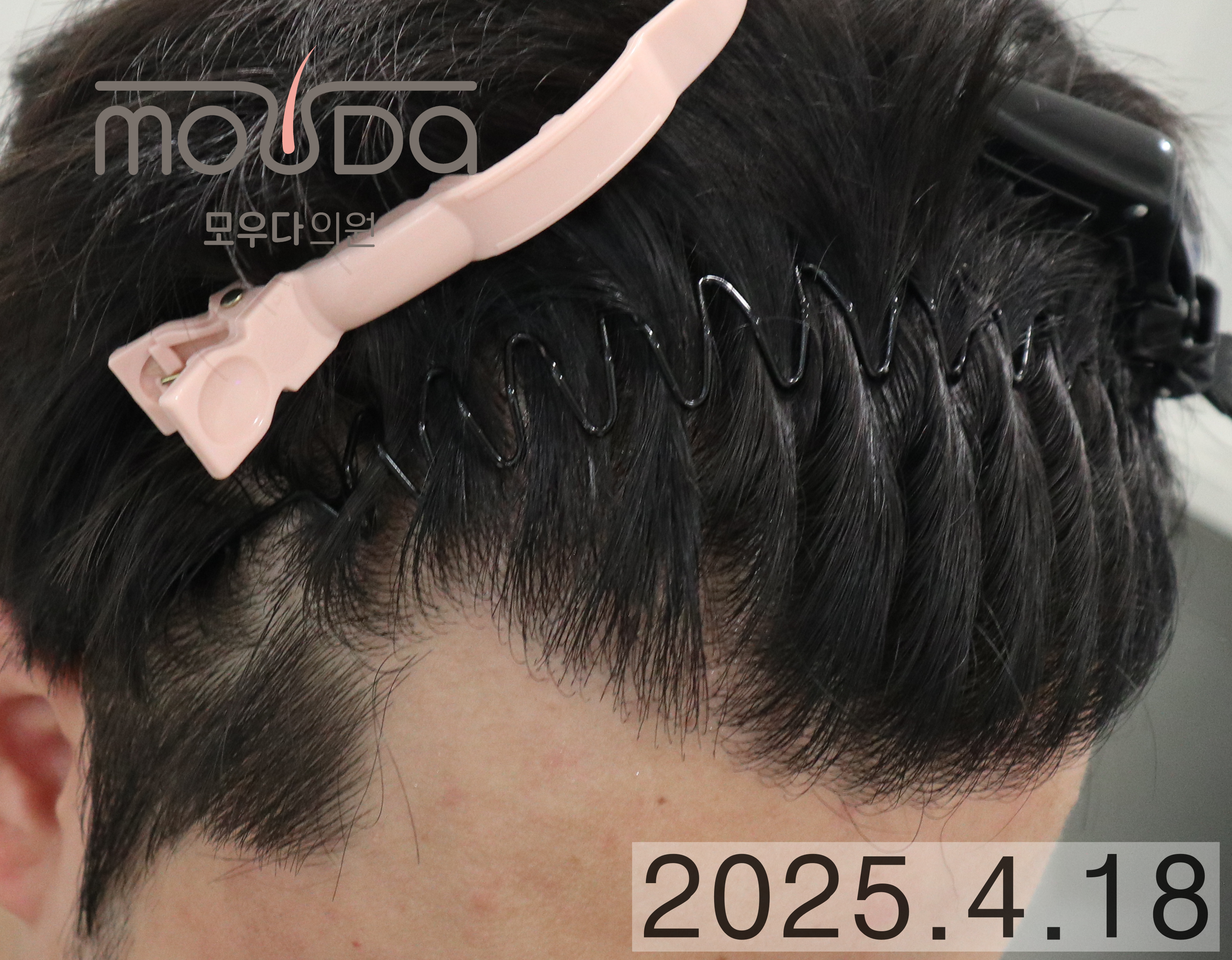 883a0dd572730.png