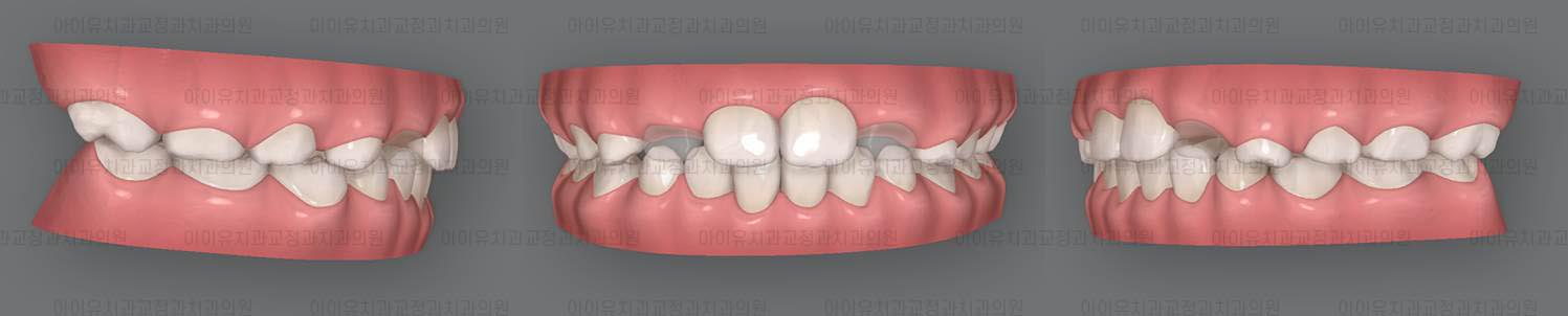 울산 교정치과 추천