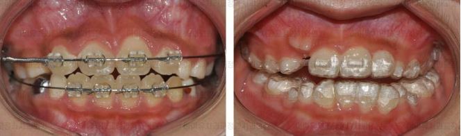 울산 치과 추천