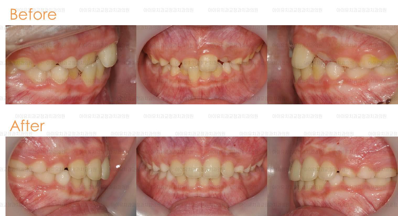 울산 인비절라인
