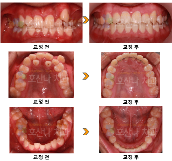 2e918b6f443fd.png