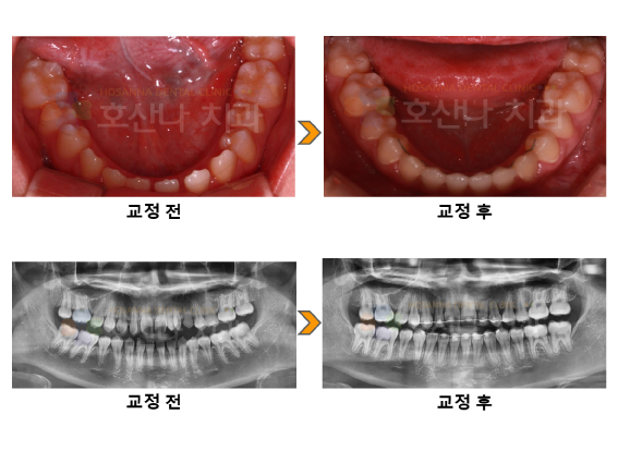 4e9006d969cc2.png