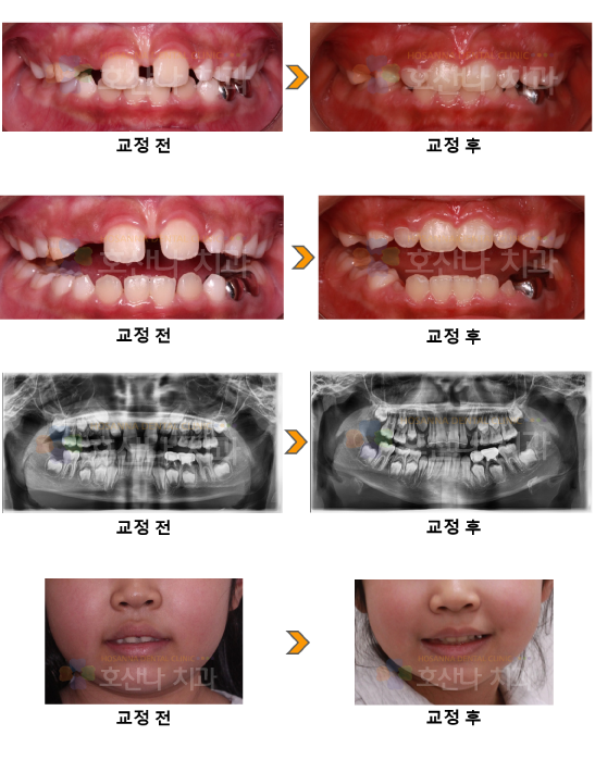 a68749a8cb158.png