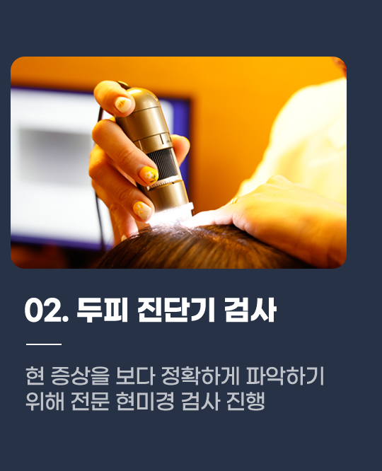 02. 두피 진단기 검사 현 증상을 보다 정확하게 파악하기 위해 전문 현미경 검사 진행