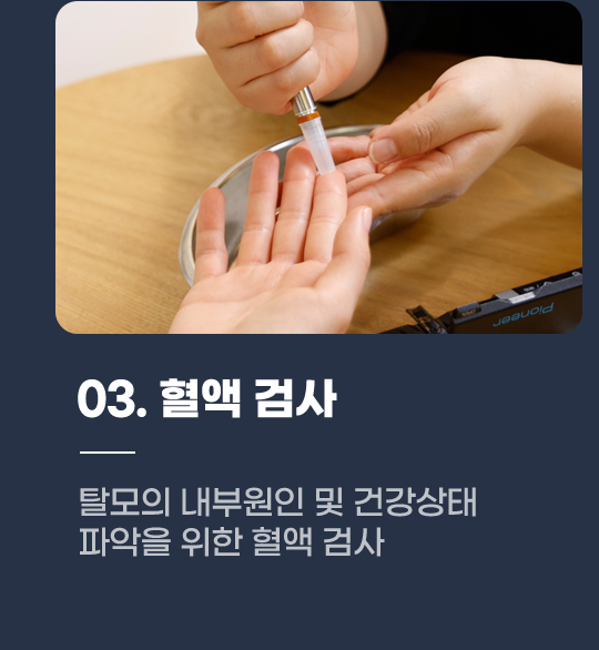03. 혈액 검사 탈모의 내부원인 및 건강상태 파악을 위한 혈액 검사 