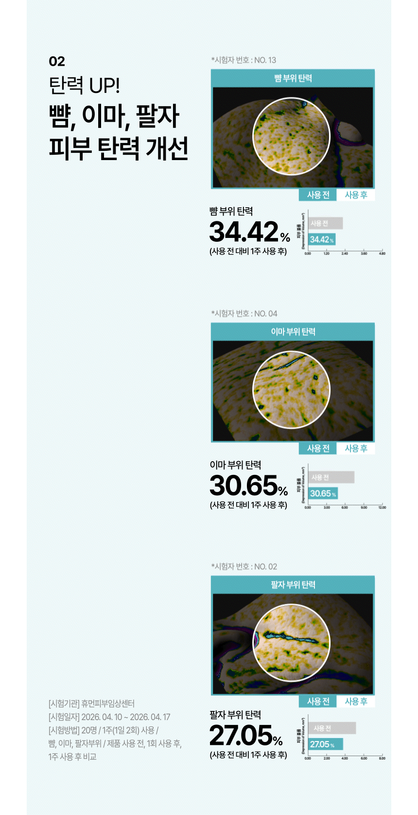 CIACLAR LEZE 아디포사 컴플렉스
