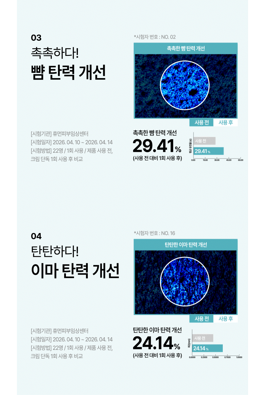 CIACLAR LEZE 아디포사 컴플렉스