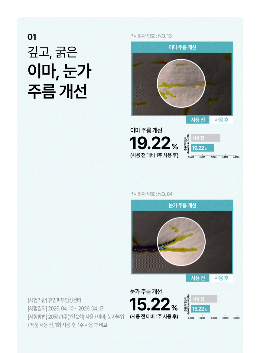 CIACLAR LEZE 아디포사 컴플렉스