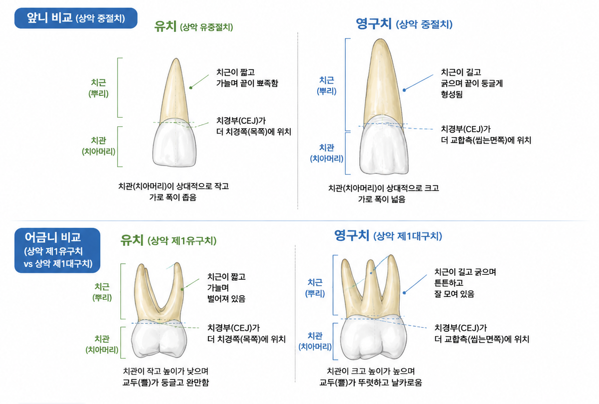 용인치과 유치임플란트 치료사례