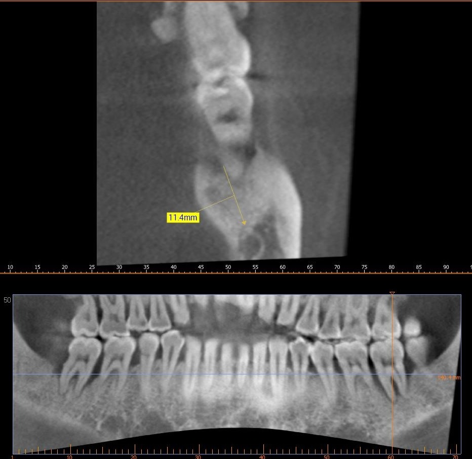 b60114e98f7cd.jpg