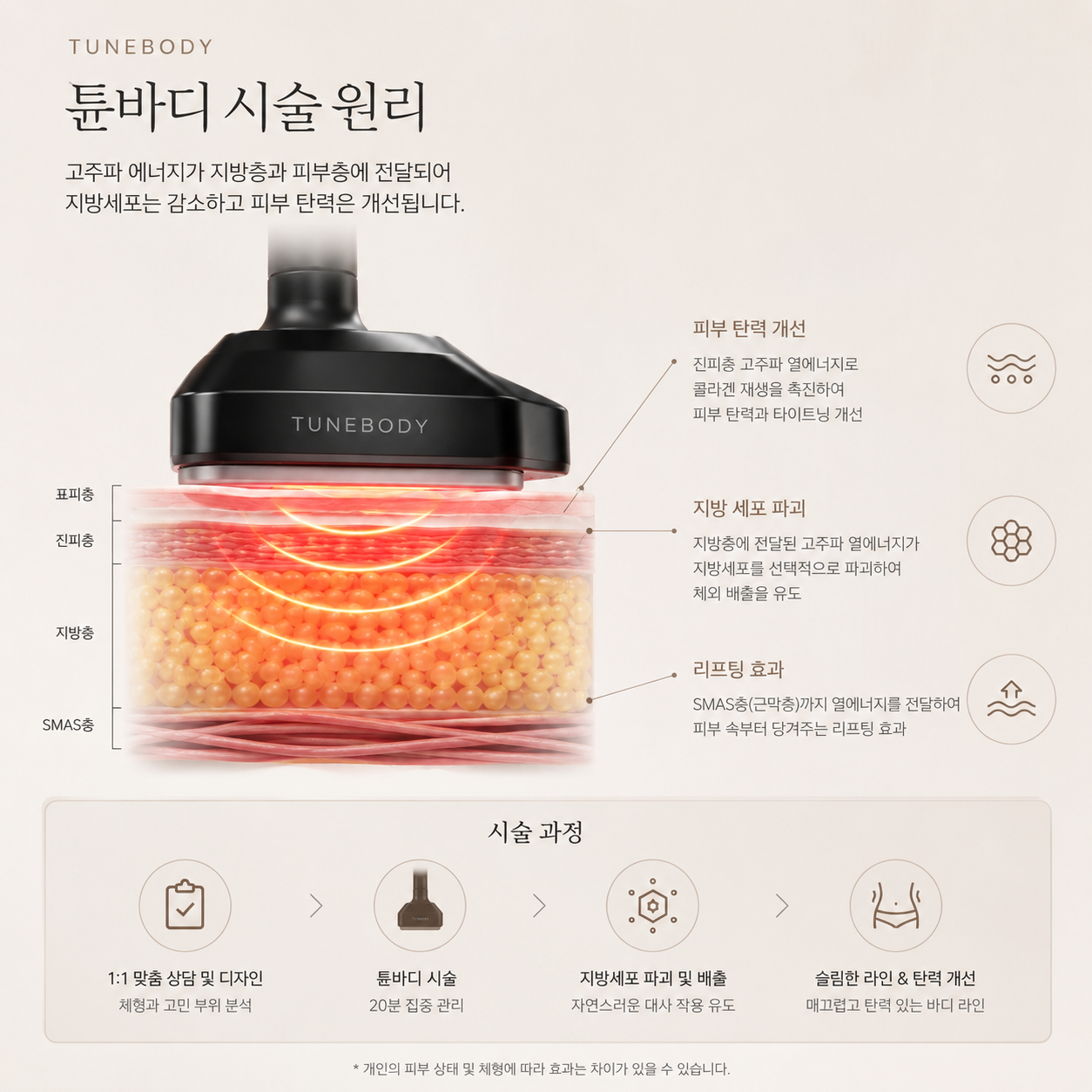 튠바디 튠라이너 지방층 타깃 관리