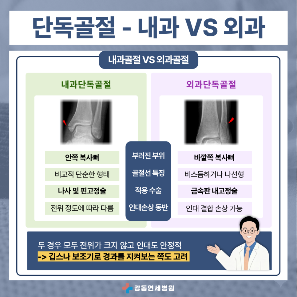 암사역사공원역 정형외과 알려드리는 단독 골절 설명