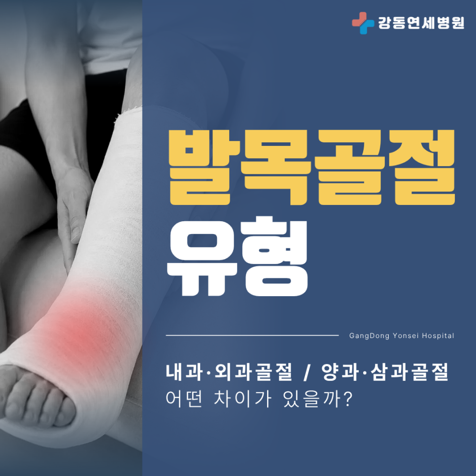 암사역사공원역 정형외과 발목 골절 종류 유형, 양과골절 삼과골절 차이