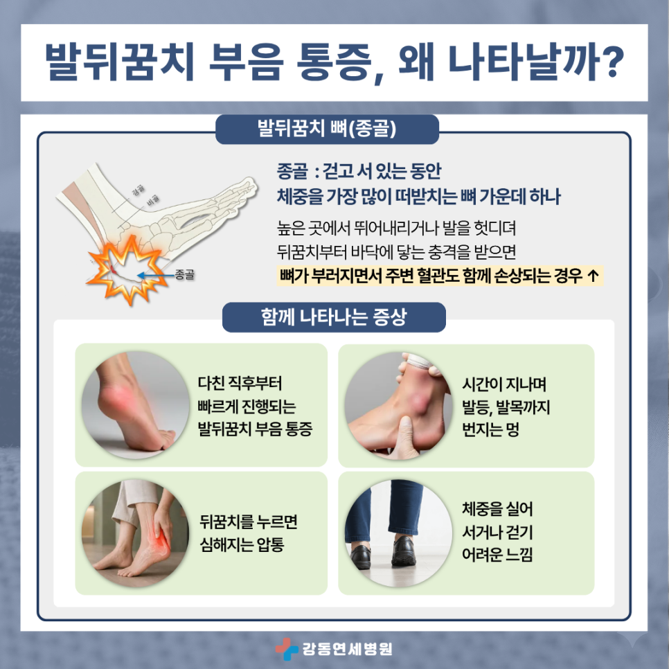 천호 고덕동 골절수술 정형외과에서 알려드리는 발뒤꿈치 부음 통증이 나타나는 이유