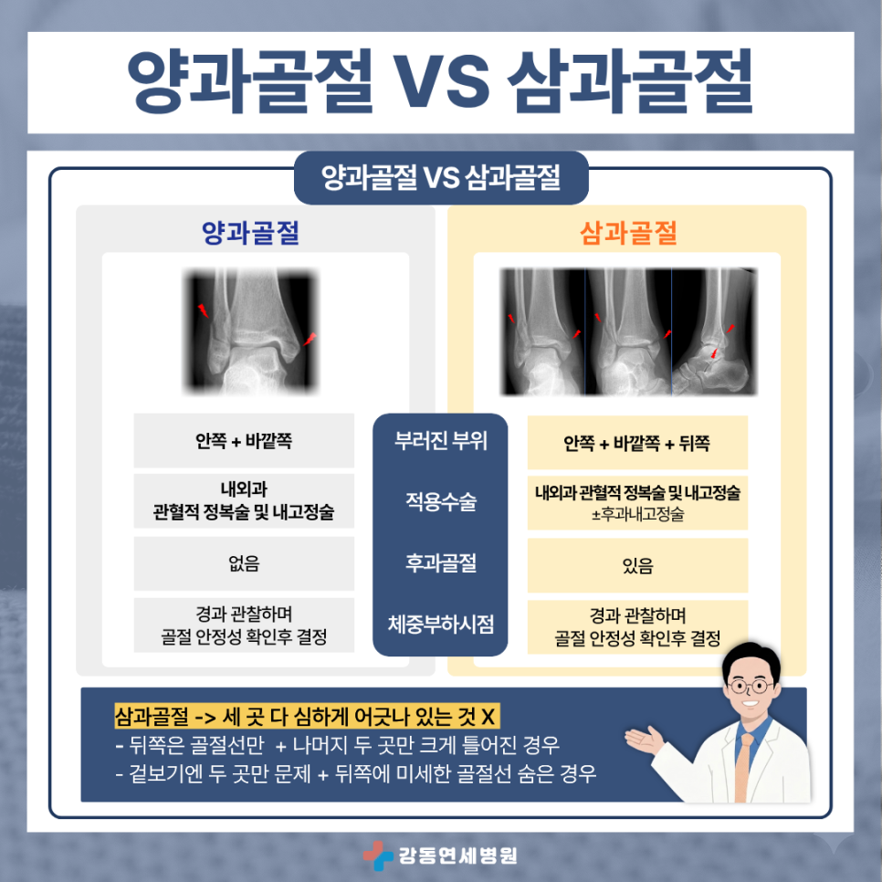 암사역사공원역 정형외과 알려드리는 양과골절 삼과골절 차이