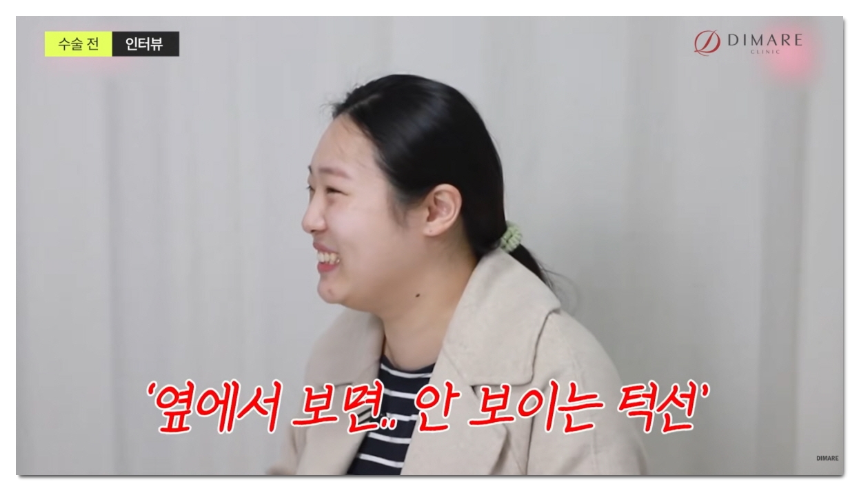 브이라인 시술, 지방흡입 전후 차이
