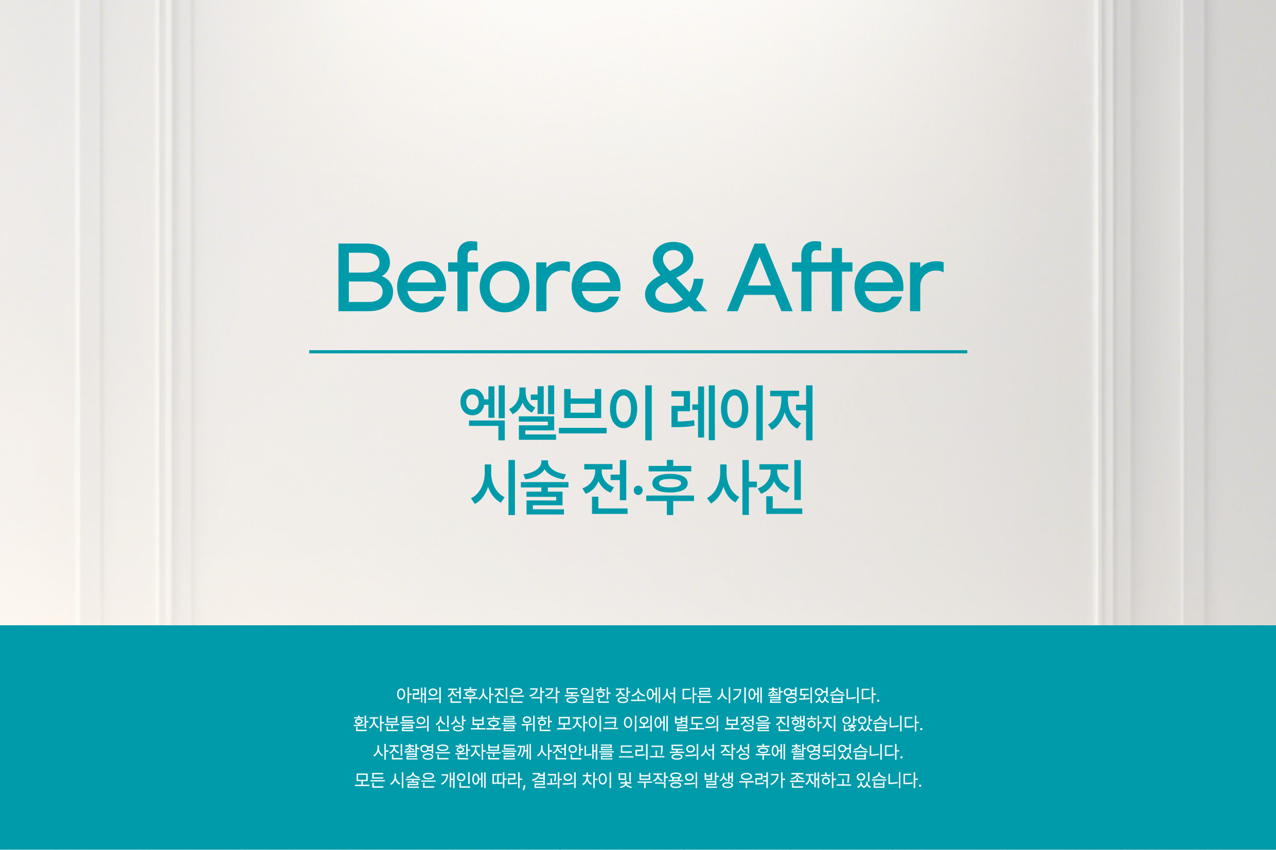 엑셀브이 레이저 : 다시봄날의원 과천점