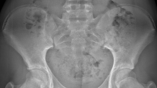 은평미올한방병원 성장클리닉 치료사례