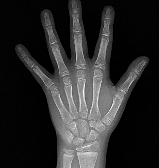 은평미올한방병원 성장클리닉 치료사례