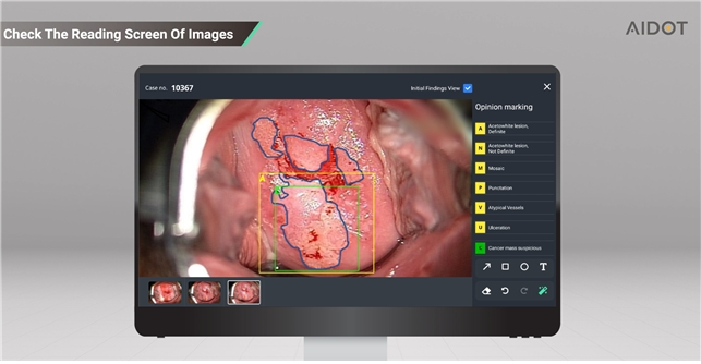 아이도트 써비레이 미국 특허 등록 완료