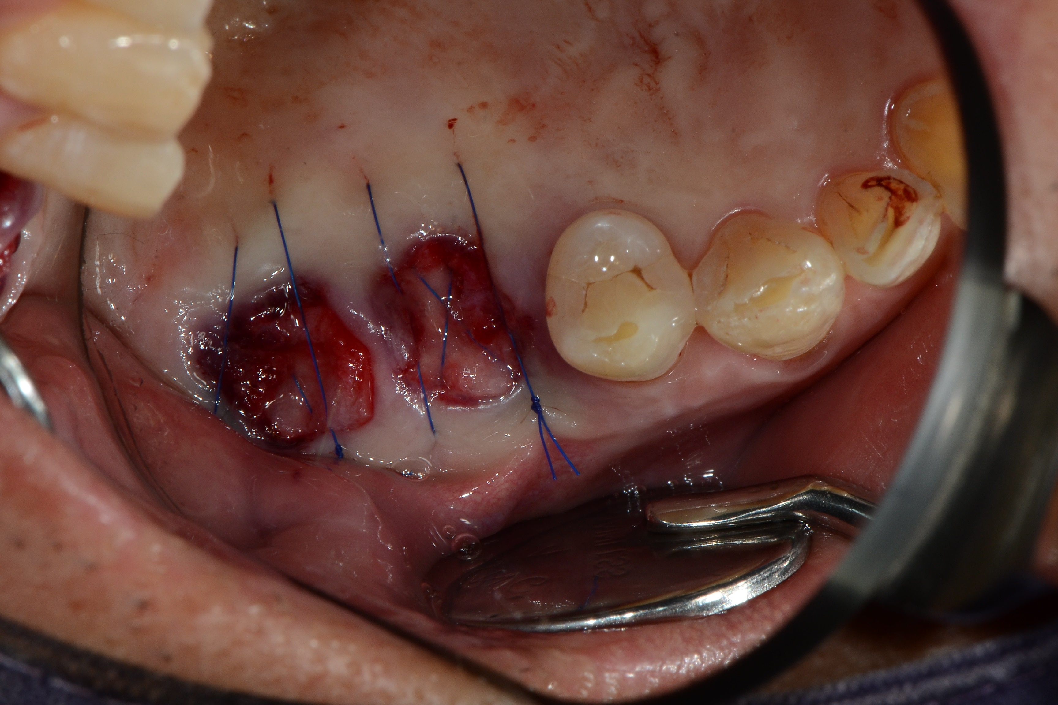 23ec90394bc7d.jpg