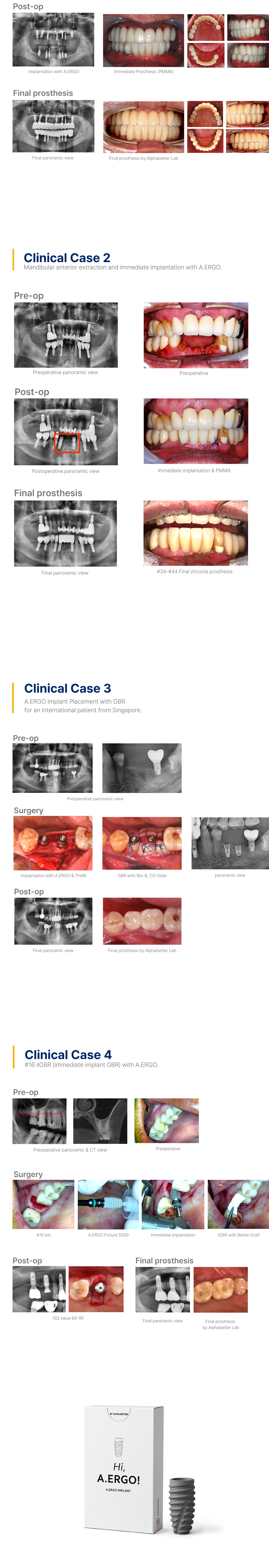 A.ERGO IMPLANT