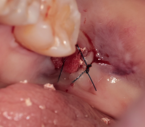 ab68c0a29730e.jpg