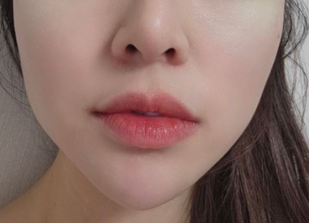 91f6d2a6720af.jpg
