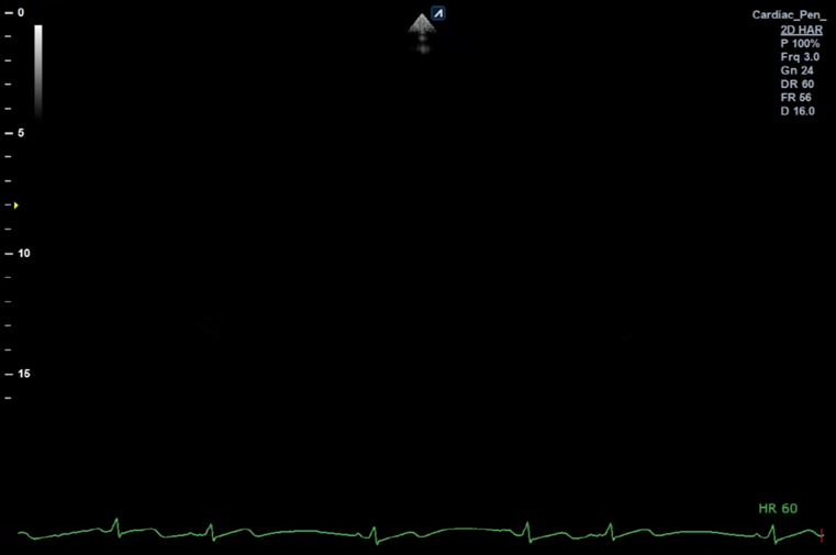 b991b7a85c810.png