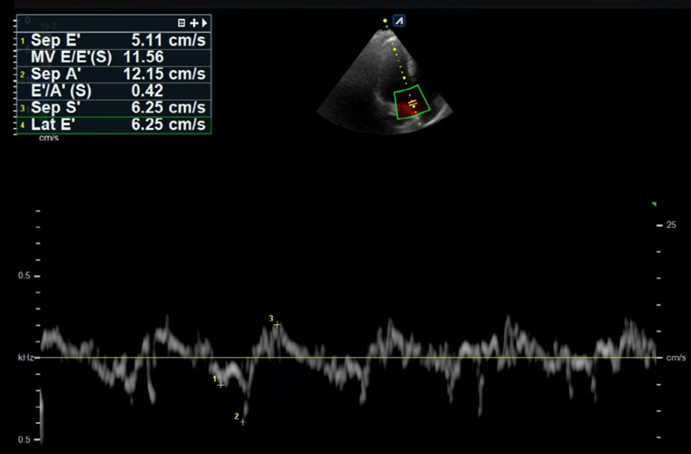 d86ed33f1176e.png