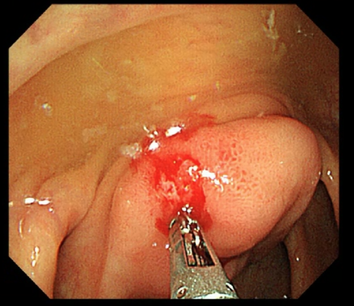 fef825c53640b.png