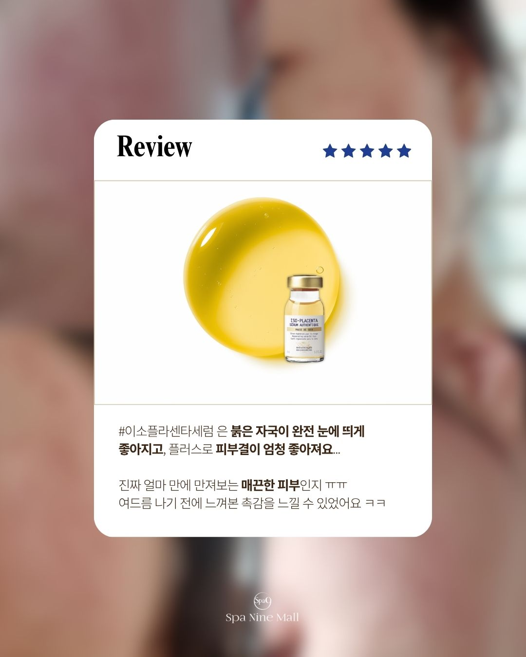 이소플라센타