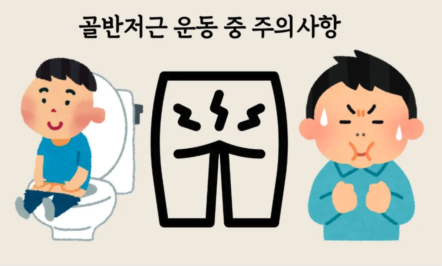 복압성요실금 요실금수술 요실금