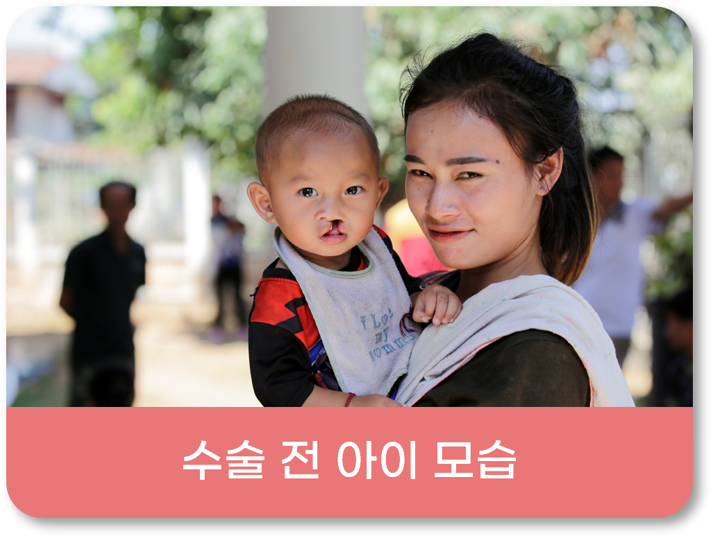 수술 전 아이