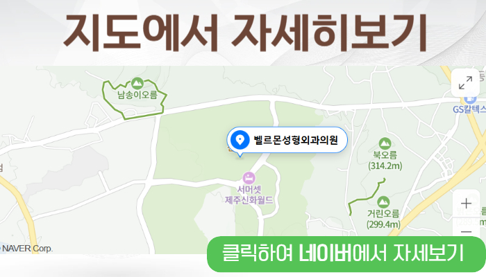 b6044417a3660.png