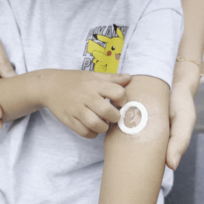 아이가 상처부위를 긁어도 손상이 가지 않는 모습