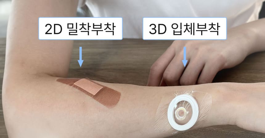 기존 밴드 대비 안다찌 보호 효과 비교 이미지