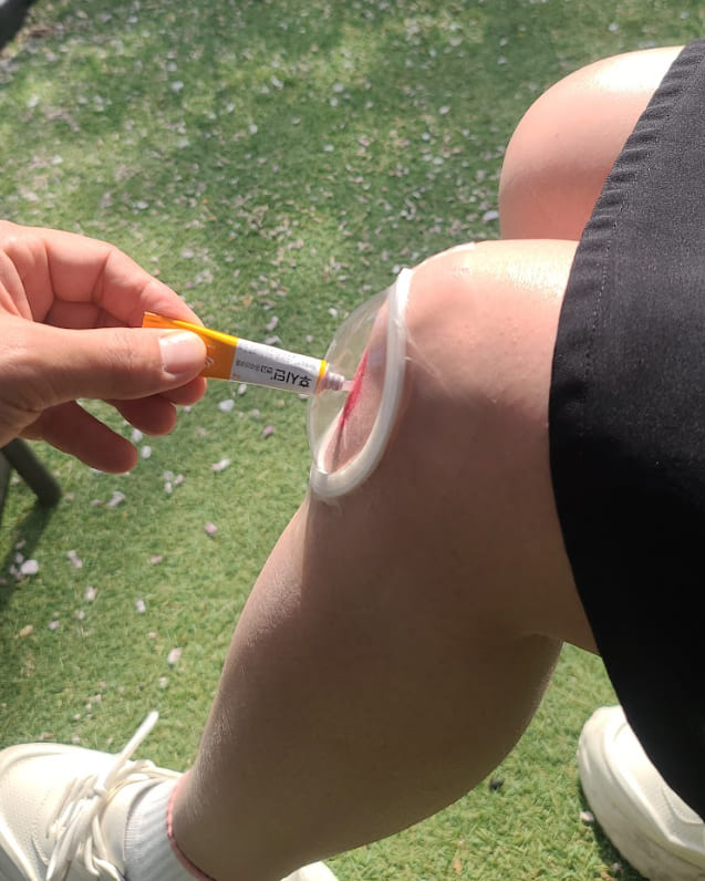 무릎 상처에 연고 도포 후 드레싱 가능한 비접촉 보호캡 예시