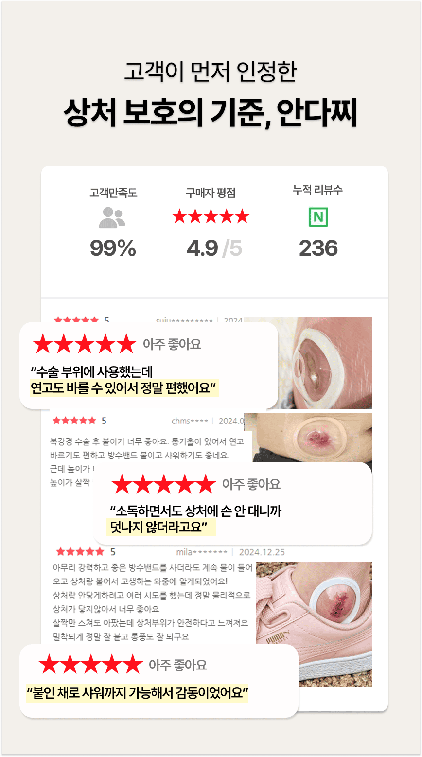 안다찌 소독형 고객 리뷰 요약 – 평점 4.9점, 리뷰 236개