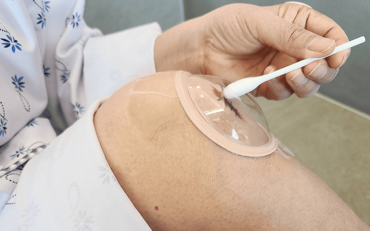 수술 후 연고 도포 가능한 안다찌 소독형 드레싱 보호캡