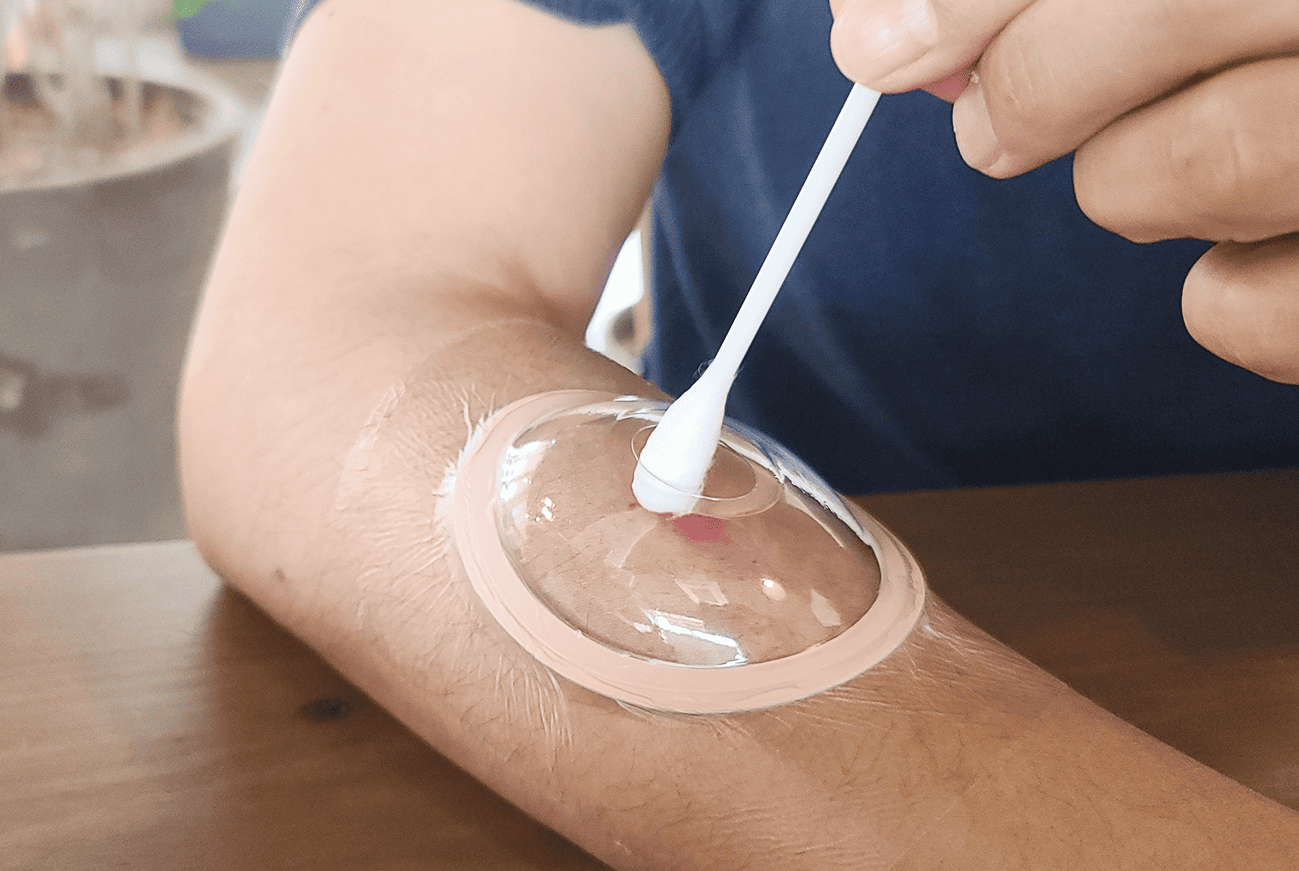 팔 상처에 연고 도포 및 보호 가능한 소독형 밴드 사용 이미지