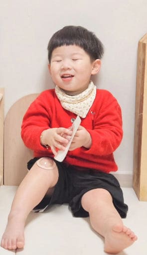 아이 무릎에 안다찌 일반형 부착 사례