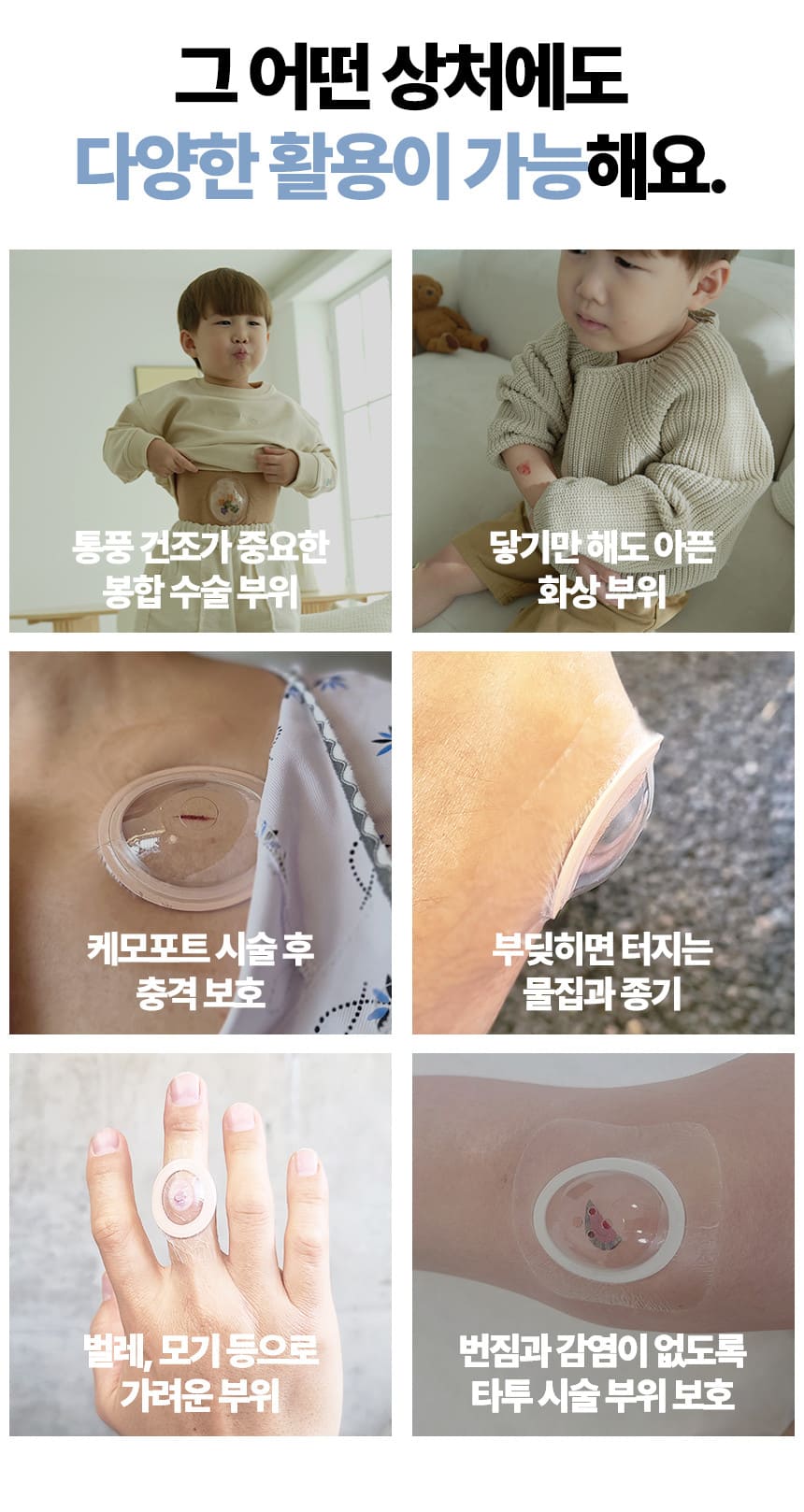 방수밴드 대체 안다찌, 상처별 사용 사례