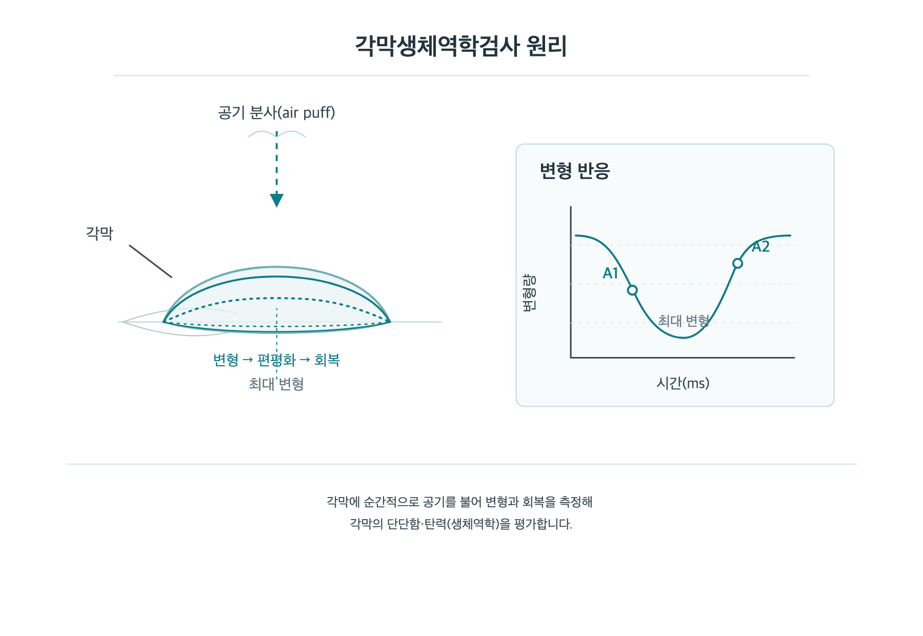 각막생체역학검사, 바람만 불어도 각막의 단단함을 알 수 있나요? 원리 도해