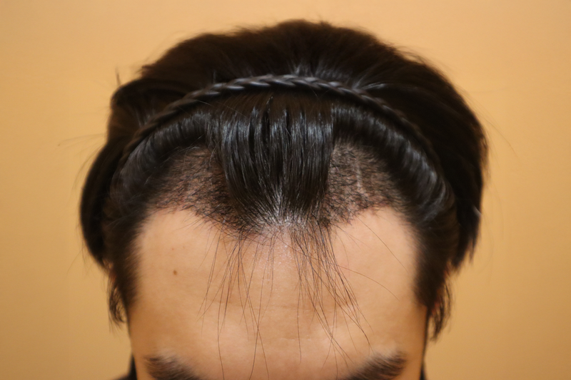 191a8c2c61536.png