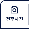 전후사진