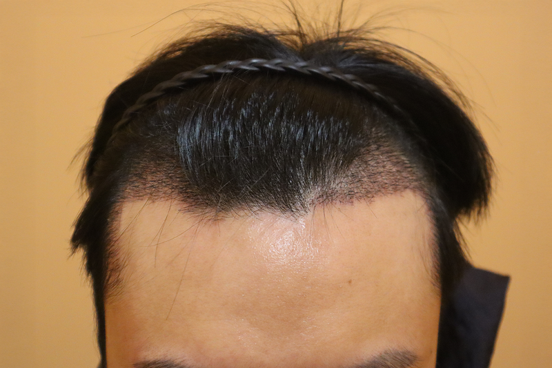 415d31681c473.png