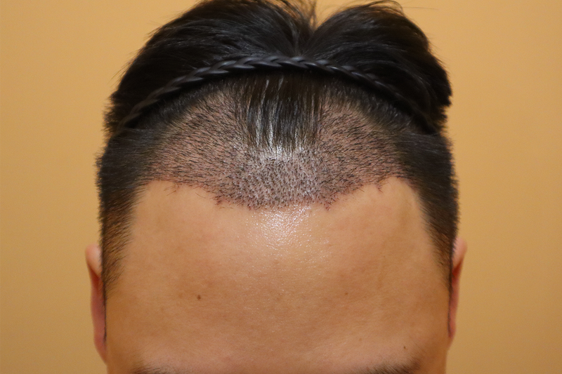 1.png 1.png