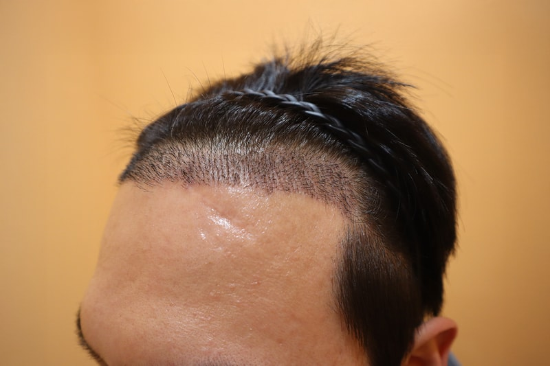 d5ab587173bfb.png